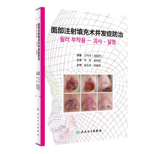 面部注射填充术并发症FANG治 商品图0