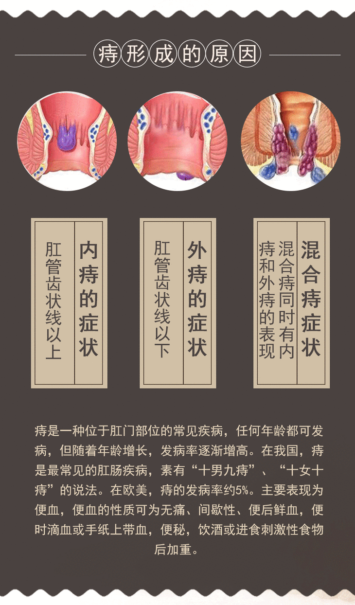 草药萃取 草本混合消痔 改善便血肛裂 除痔不留根痔疮膏 
