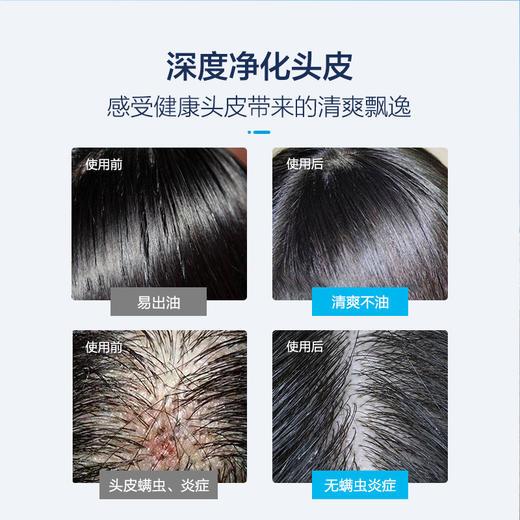 盐致舒缓磨砂膏——专为头皮问题研制 商品图3