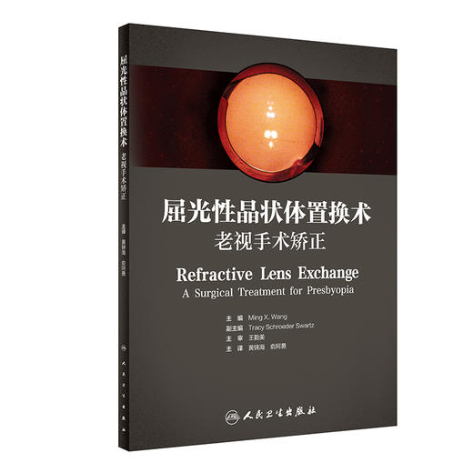 屈光性晶状体置换术：老视手术矫正 商品图0