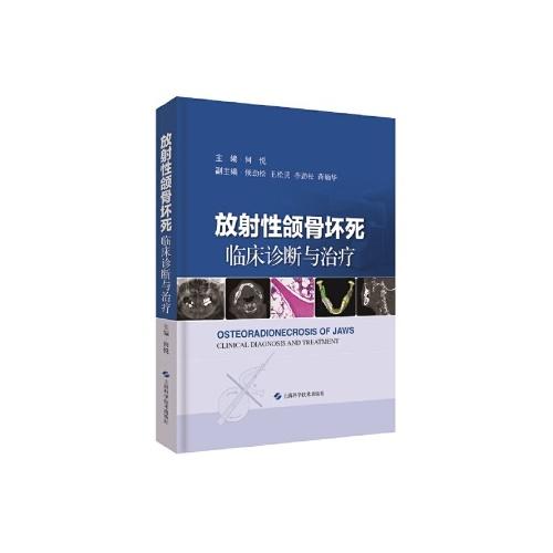 放射性颌骨坏死:临床诊断与治疗(精)/化学工业出版社/翟瑞波9787547845943 商品图0