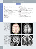 国际经典影像诊断学丛书--《儿童神经影像诊断学（原著第 2 版）》 商品缩略图2