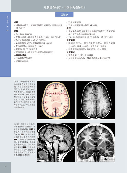 国际经典影像诊断学丛书--《儿童神经影像诊断学（原著第 2 版）》 商品图2