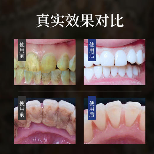 【藏秘牙膏】天然藏药配方，美白牙齿祛牙渍，赶走大黄牙，口臭、牙龈肿痛、出血、溃疡均可用 刺激 120g/支 商品图1