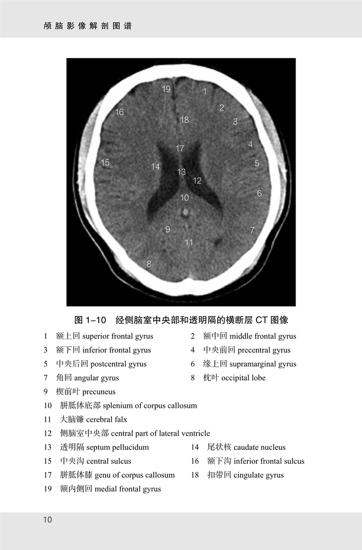 颅脑影像解剖图谱 主编:刘树伟 丁娟 侯中煜 山科出版