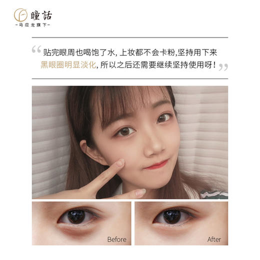 马应龙瞳话眼贴——眼周喝饱水，年轻不靠“妆" 商品图1