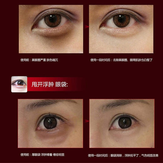 it‘sskin伊思红参蜗牛滚珠眼霜15ml*2 商品图2