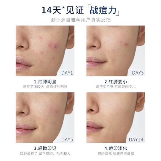 雅萌（YA-MAN）11t美容仪仪器导入补水仪脸部 提拉瘦脸仪HRF-11 商品图3