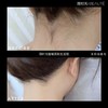 #简世光BEAUTE-精准护肤#【808半导体冷肤无痛脱毛】限时7折优惠 商品缩略图4