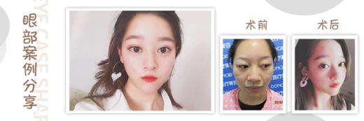 有运费 商品图0