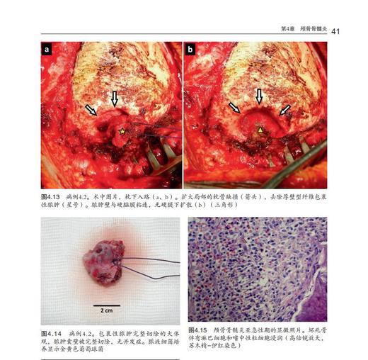 《颅脑及脊柱术后感染诊疗手册》 商品图5