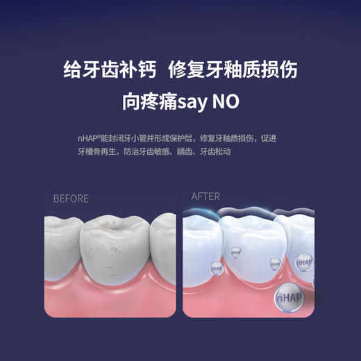 北大口腔护理科技推广成果：舒适雅nHAP牙膏●牙周专用版 商品图2