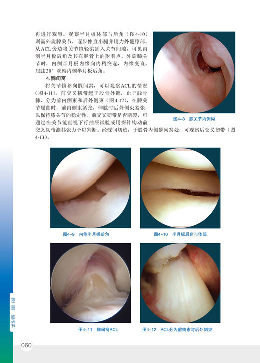 骨科精萃系列--实用关节镜手术学    主编：刘玉杰    化工出版 商品图4