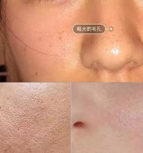  80%的女生都不会去角质！难怪毛孔粗大，长闭口痘痘 