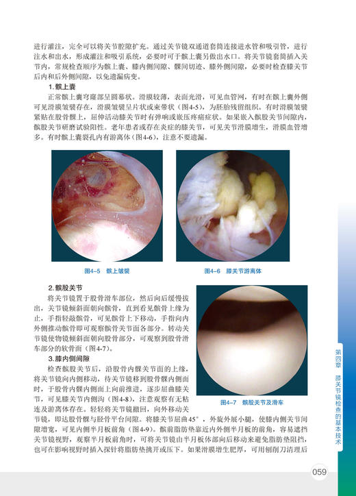 骨科精萃系列--实用关节镜手术学    主编：刘玉杰    化工出版 商品图3