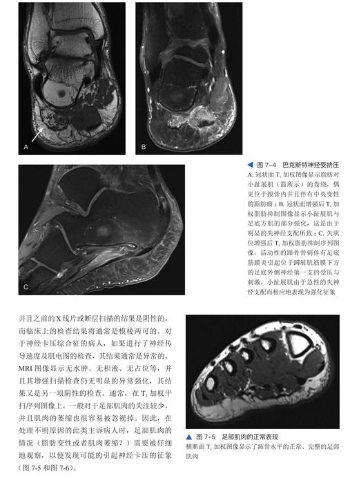 足踝影像诊断学  国际经典影像学译著 一部由德国影像学专家、足踝外科专家共同编著的足踝外科经典著作 商品图7