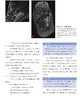 足踝影像诊断学  国际经典影像学译著 一部由德国影像学专家、足踝外科专家共同编著的足踝外科经典著作 商品缩略图6
