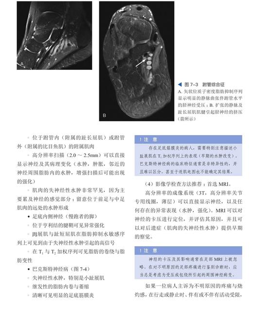 足踝影像诊断学  国际经典影像学译著 一部由德国影像学专家、足踝外科专家共同编著的足踝外科经典著作 商品图6