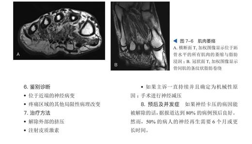 足踝影像诊断学  国际经典影像学译著 一部由德国影像学专家、足踝外科专家共同编著的足踝外科经典著作 商品图8