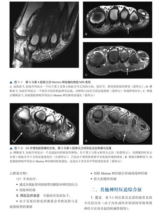 足踝影像诊断学  国际经典影像学译著 一部由德国影像学专家、足踝外科专家共同编著的足踝外科经典著作 商品图3