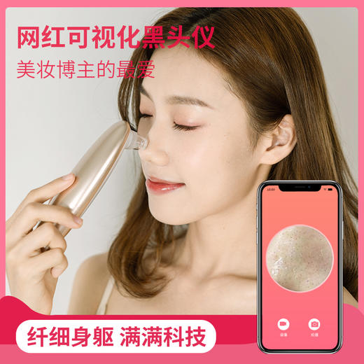 UDU可视化黑头仪 商品图1