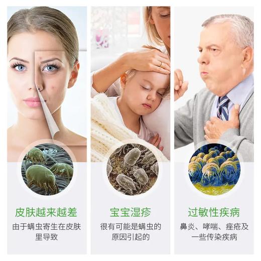 【植物除螨】青花椒除螨喷雾——植物萃取，孕婴适用 商品图1