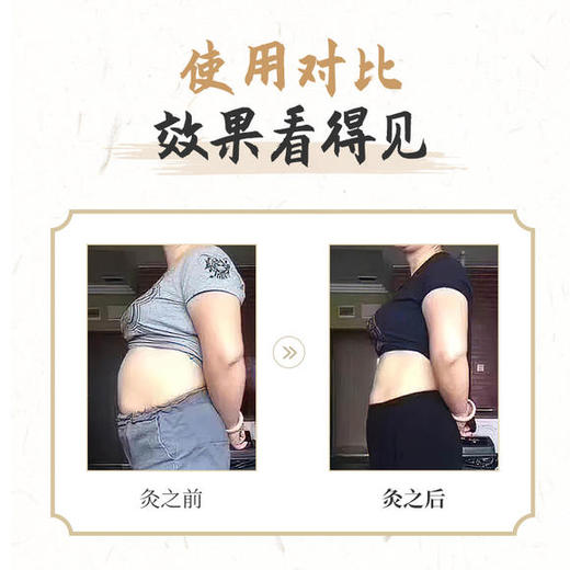 御恒堂排油灸——好身材，灸出来 商品图3