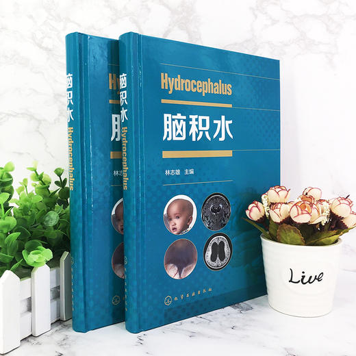 脑积水 商品图1