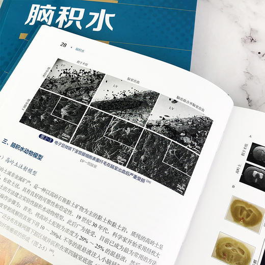 脑积水 商品图7