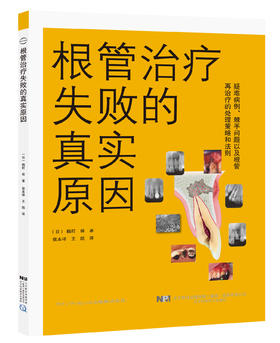 《根管治0疗失败的真实原因》