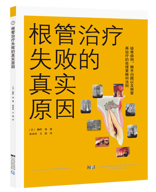 《根管治0疗失败的真实原因》 商品图0