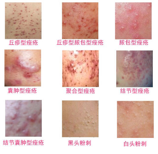 爱肤宝（30克） 商品图7