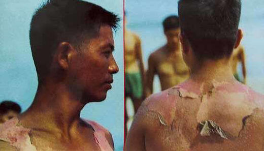 爱肤宝（30克） 商品图6