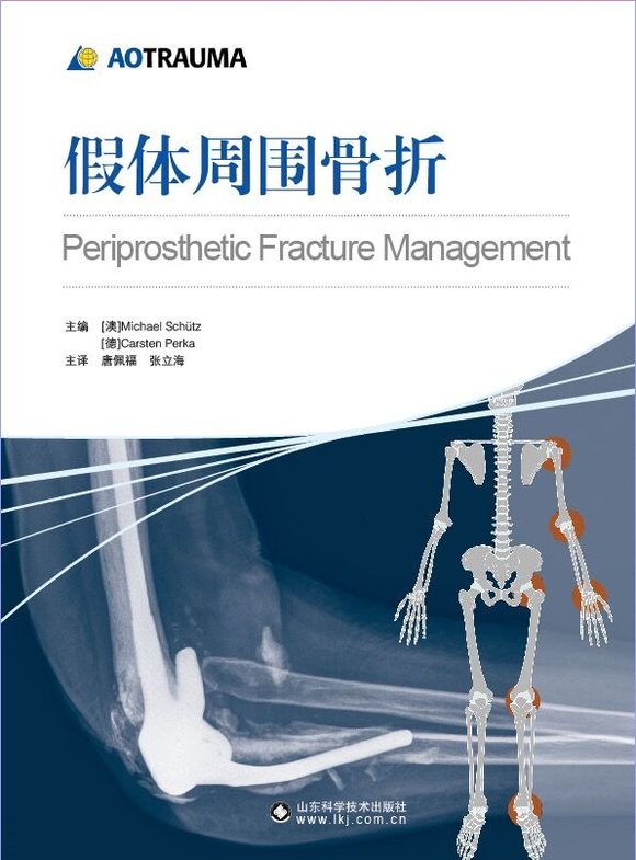 (AOTRAUMA)假体周围骨折---301医院唐佩福教