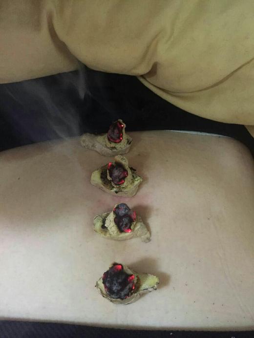 陈德识国医艾灸养生馆 拼团活动了！原充值1000送200，现在充值1000送800。陈德识艾灸养生堂店庆20周年拼团回赠活动，名额20个，活动时到2016年9月25日结束。 商品图3