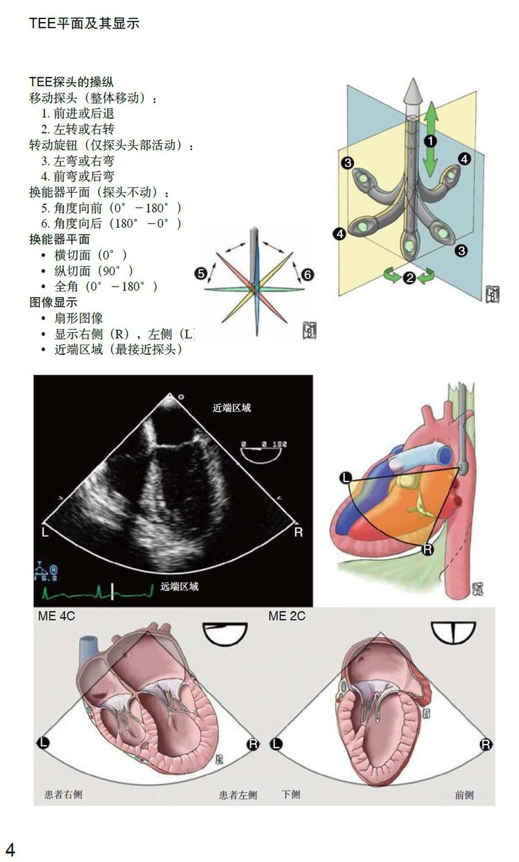 常规二维超声心动图图片