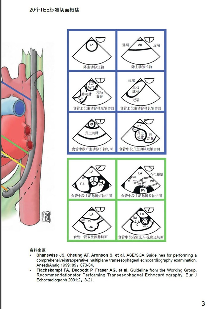 《围术期二维经食管超声心动图实用手册》 北医社 鞠辉冯艺 主译