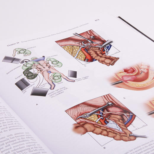 【正版包邮】Maingot腹部手术（第12版）（英文版） Maingot's Abdominal Operations 商品图4