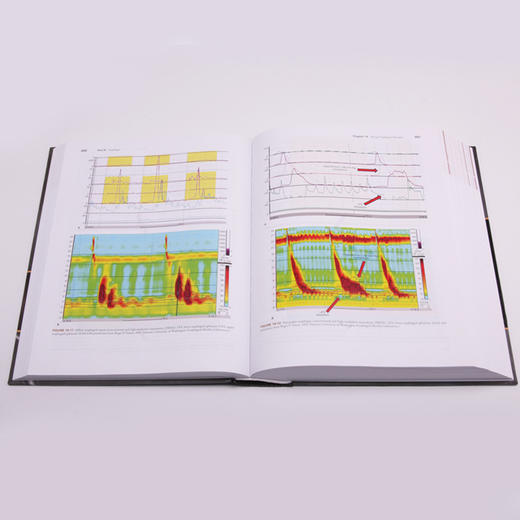 【正版包邮】Maingot腹部手术（第12版）（英文版） Maingot's Abdominal Operations 商品图3