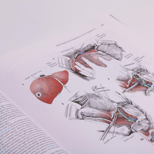 【正版包邮】Zollinger外科手术图谱（第10版）（英文版） Zollinger’s Atlas of Surgical Operations 商品图6