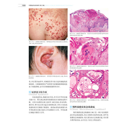 【出版社直发】现货！中国临床皮肤病学(上下册)第2版 皮肤科医生参考用书皮肤科考博指定用书资料新颖全彩图文互释 商品图1