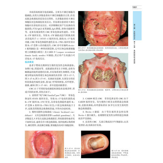 【出版社直发】现货！中国临床皮肤病学(上下册)第2版 皮肤科医生参考用书皮肤科考博指定用书资料新颖全彩图文互释 商品图2