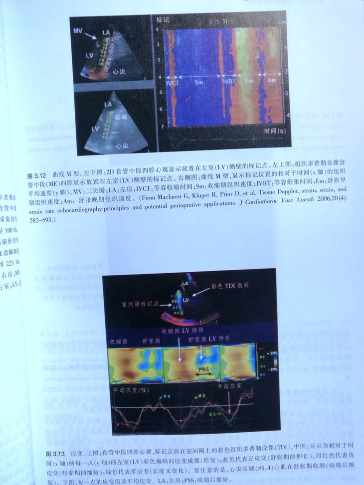 附录1  经食管超声心动图解剖学 附录2  心脏大小测量 附录3  血流