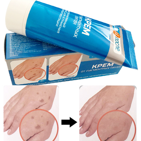 【妈妈粉的最爱】kpem牌手霜 祛斑去除手斑老年斑 护手霜50ml/支