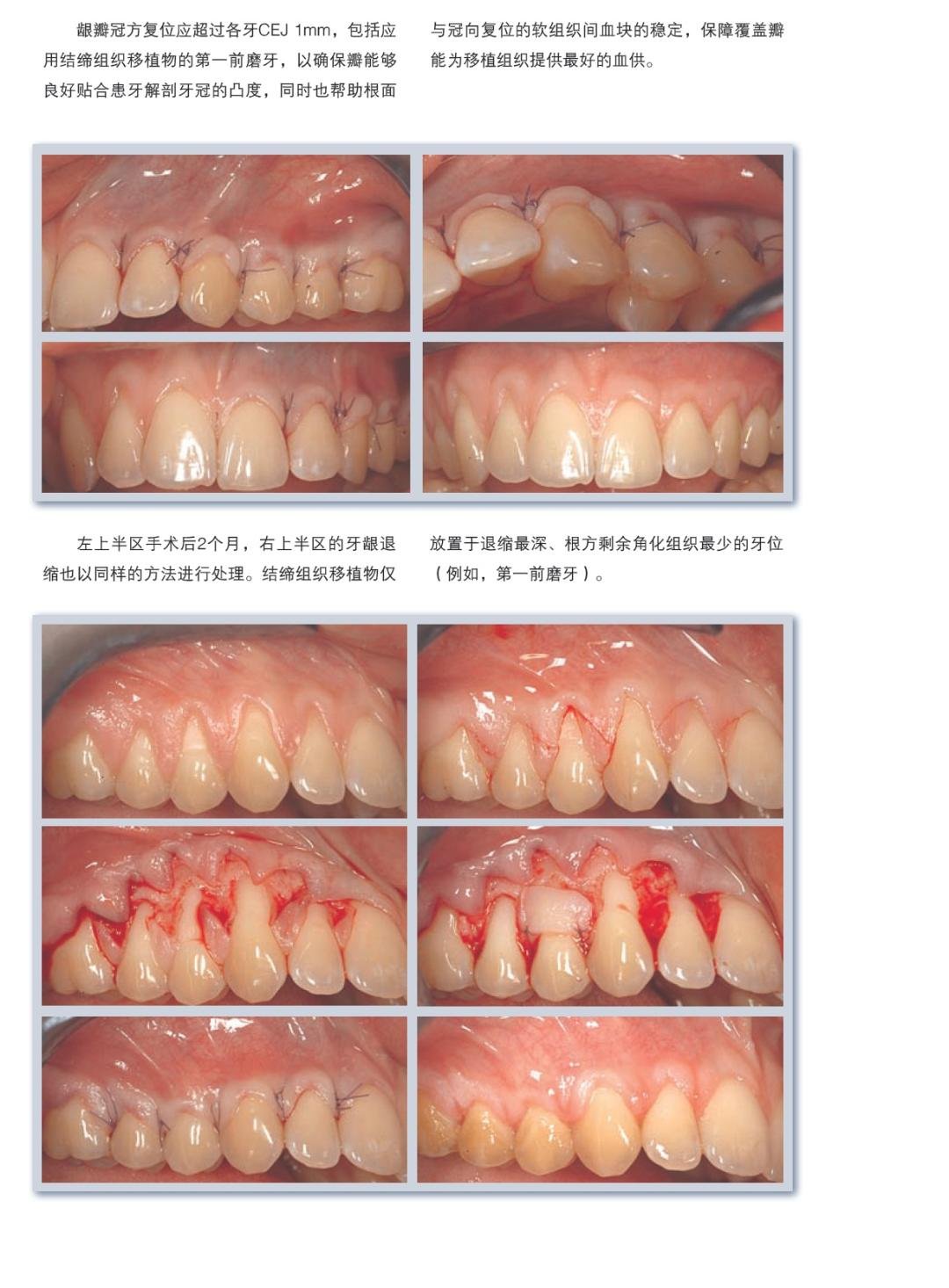 膜龈美学手术精要 - kq88口腔商城