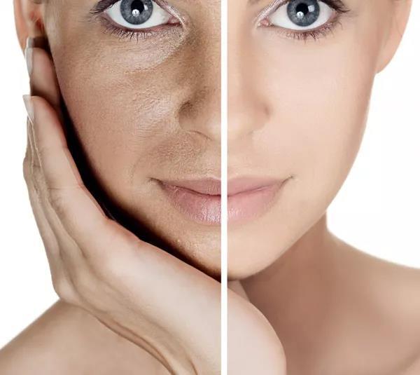 防晒,不仅仅只是为了不被晒黑!