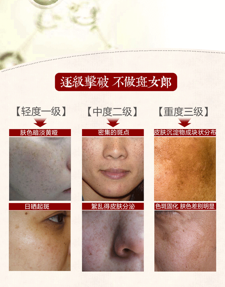 美主人美白祛斑霜 美白淡斑祛雀斑日晒斑去黄美白霜 唐织绾