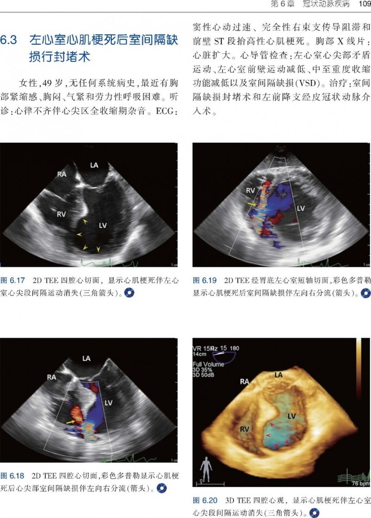 来源于临床的术中图片,包括2d和3d经食管超声心动图,x线透视和ct影像
