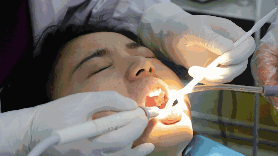 普丽斯牙齿美白组 | 医疗级美白牙托,7天牙齿白10度