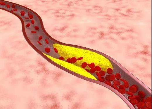 血管里真的有很多垃圾吗？ 商品图0